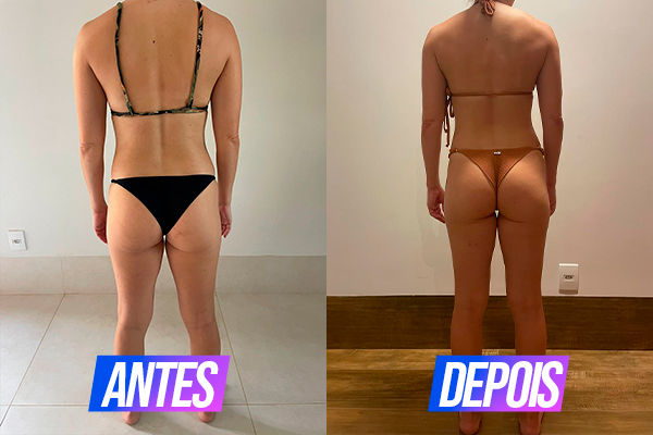 01-Ana